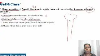 Hypersecretion of growth harmone
