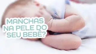Seu filho está com mancha na pele? Pode ser Dermatite Atópica...
