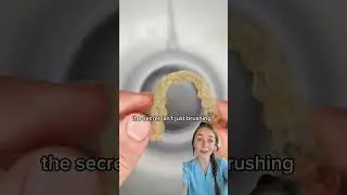 Do invisalign or retainer smell bad?
