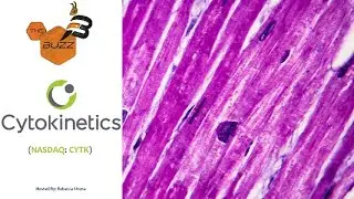 &ldquo;The Buzz'' Show: Cytokinetics, Inc. (NASDAQ: CYTK) Positive Phase 2 Clinical Trial Results