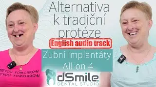 All-on-4: N&aacute;hrada zubů ve 45 letech &ndash; Konec s prot&eacute;zou!#implant#dentist #dsmile#allon4dentalimplants