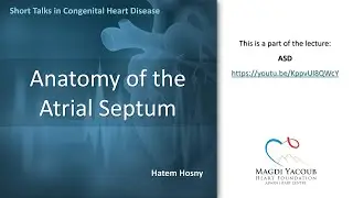 Anatomy of the Atrial Septum - Hatem Hosny