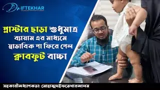প্লাস্টার ছাড়া শুধুমাত্র ব্যায়াম এর মাধ্যমে স্বাভাবিক পা ফিরে পেল ক্লাবফুট বাচ্চা ।