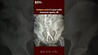Patient said it's just mild stomach upset&hellip;😅 #healthchannel #doctorslife #doctor #doctorslife #ask
