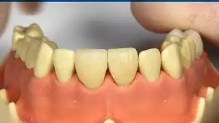 composite polishers