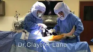 Mako Robotic Partial Knee replacement