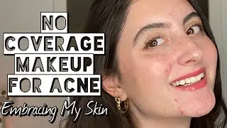 NO COVERAGE Makeup For Acne | Embracing My Skin w/ this Summer Makeup Routine to Enhance Features