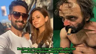 Ravi Dubey Looks Unrecognisable after Shocking Transformation & Surgery! Ravi Dubey Transformation