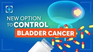 New option to control bladder cancer