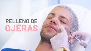 David Lafuente elimina Ojeras - Clínicas Diego de León