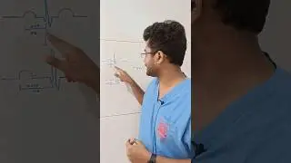 Do You Have a Minute || First Degree Heart Block #aetcm #emrapid