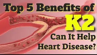 TOP FIVE BENEFITS OF VITAMIN K2