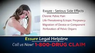 McDivitt Law Firm - Essure Legal Helpline (2016)
