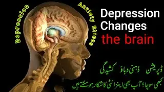 Depression Ka Ilaj | Clinical depression | Depression Therapy | Mental Health | Urdu | Hindi
