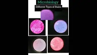 Microbiology| Different Types of Stains