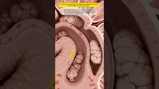 The Slow-Growing Polyps That Become $300,000 Cancer (If You Skip Your Colonoscopy)