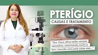 PELE CRESCENDO EM CIMA DOS OLHOS: O QUE É PTERÍGIO, CAUSAS E TRATAMENTO | DRA. ANGÉLICA VILELA