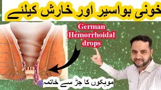Homeopathic medicine for piles!R No13!how to work!symptoms!how to use@hassan homeopathic