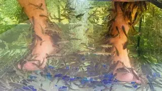 Doctor fish! | #doctorfish #fish #fishpond