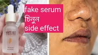 নকল serum চিনুন | how to use white rice serum vitamin c serum