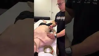 Thorasite Dispositivo criado pela SAM medical