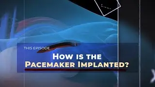 How is the Pacemaker implanted?