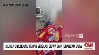 Diduga Dirundung Teman Sekelas, Siswa SMP Terancam Buta