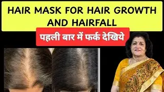 घरेलु hair mask 15 दिन मे बालो से भर जायेगा सर #hairfalltherapy  #trendingvideo #haircare #