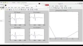 ECG Entropy1