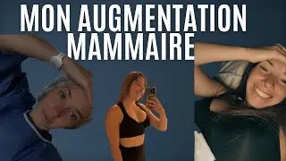 MON AUGMENTATION MAMMAIRE, SATISFAITE ? Coach Ad&eacute;