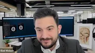 AI in Healthcare