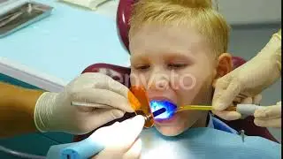 Health Concept. Boy at Dental Clinic Gets Dental Treatment To Fill a Cavity in Tooth. Dental | S...