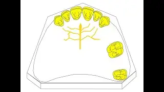 Desenho da estrutura metálica em PPR - caso Classe II Mod 2