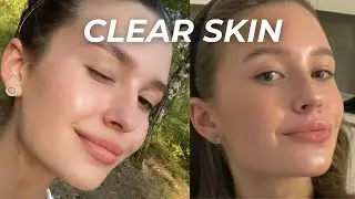 How I got KOREAN GLASS SKIN AT HOME  *NATURALLY* | 9 tips