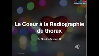 Radiographie normale du cœur et du médiastin.