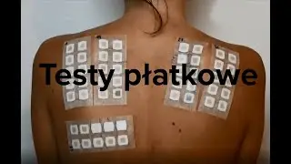 Testy Płatkowe: Wykonywanie