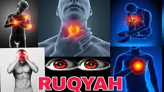 Ruqyah Shariah for Evil eye, Envy and Magic - Beautiful - Peaceful - Helmy El-Sayed