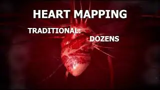3D MAPPING TO FIND AND TREAT HEART ARRYTHMIAS
