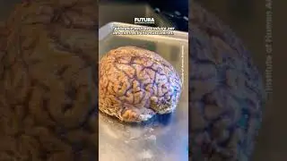 L&rsquo;analyse et l&rsquo;&eacute;tude d&rsquo;un vrai cerveau humain !