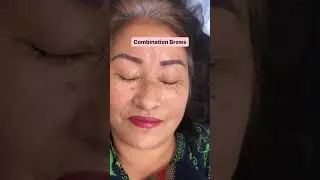 Combination Brows Transformation done by our experts at Dermalyn Aesthetics | Dermalyn Aesthetics |