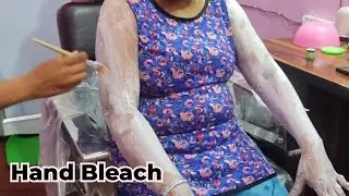 Which bleach is good for hands?Does bleach remove skin tan? #trending #bleach