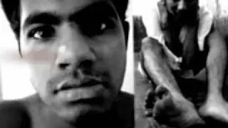 drugs(Anu.C.J)