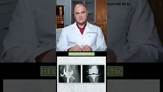 Заменил коленный сустав и пожалел об этом
