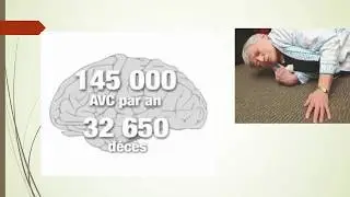Nutrition Sante: LE CHOLEDUZ en Francais