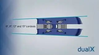 Amplify Surgical: dualX TLIF Animation