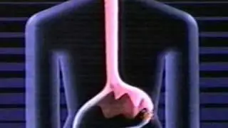1986 Pepto Bismol commercial