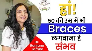 50 की उम्र में भी Teeth Braces लगवाना हैं संभव | Teeth Braces Age Limit | Usha Smile Care, Sikar