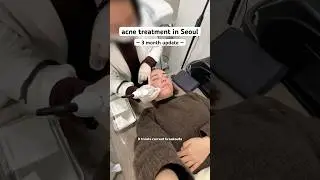 Collab || 3 MONTHS of acne treatments done #korea