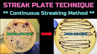 Streaking Technique | Continuous Streaking | Pure Culture | A Complete Procedure | Microbiology