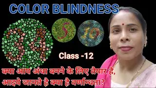 GENETICS | Principle Of Inheritance |Human Color blindness | Cris Cross Inheritance | Class -12 |😊👍